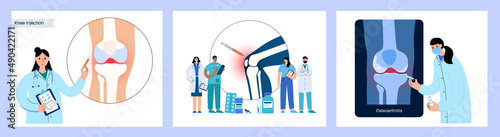 Knee Injection procedure