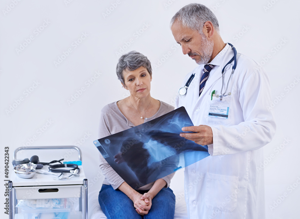 Simplifying the x-ray so she can understand. Shot of a doctor explaining a x-ray to a patient. Simplifying the x-ray so she can understand. Shot of a doctor explaining a x-ray to a patient.