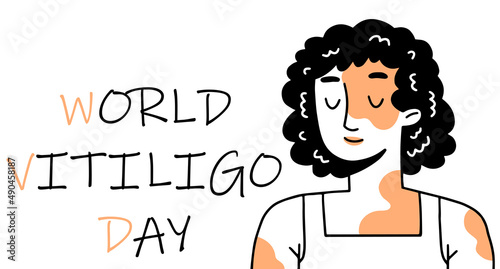 World vitiligo day poster. A smiling woman with problematic vitiligo skin in a doodle style. Vector illustration.