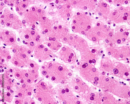 Human liver. Hepatocytes. Trinucleated hepatocyte photo