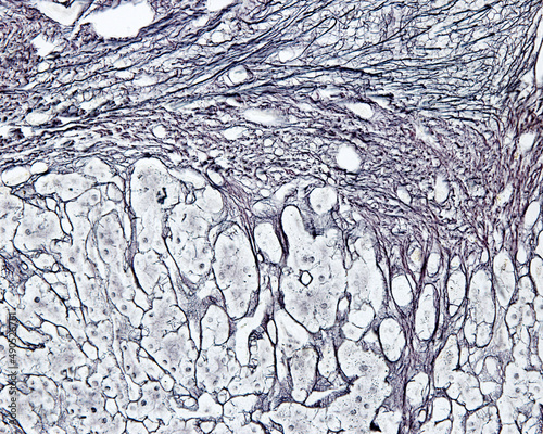 Human liver. Cirrhosis. Silver stain photo