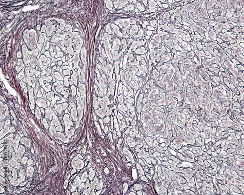 Human liver. Cirrhosis. Silver stain photo