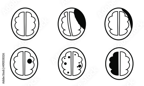 Infographic of lesion or pathology of ct brain