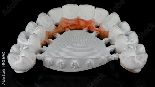 morphology of teeth dental prosthesis from zircon of the upper jaw on a black background