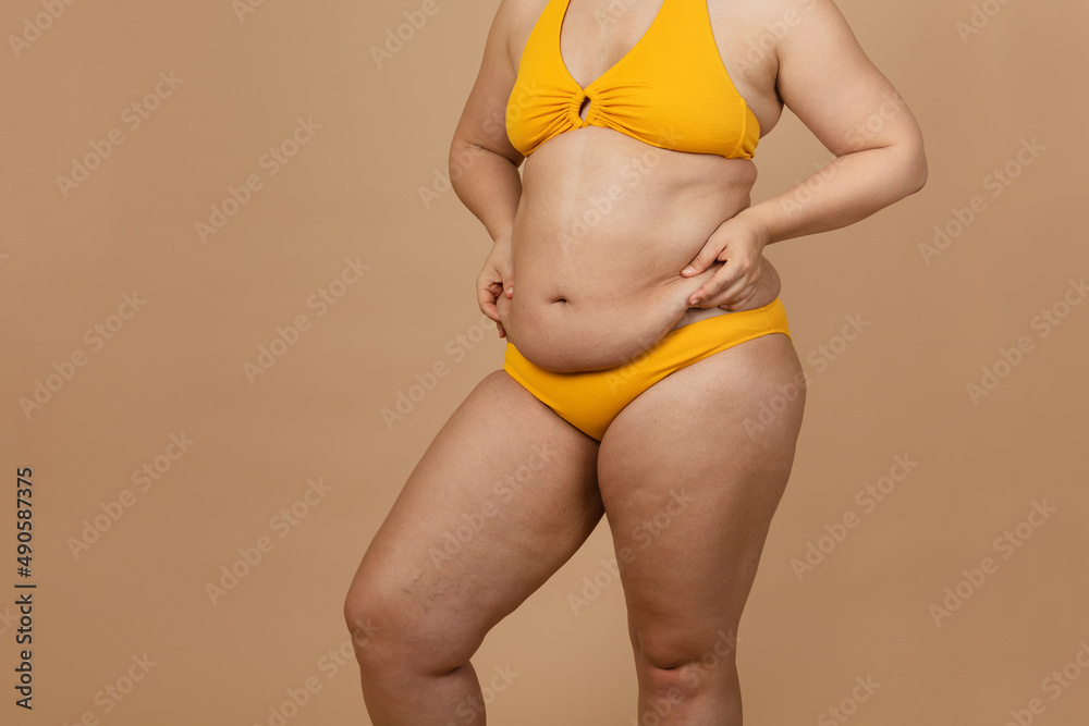 Cropped image of overweight woman, tucking, hiding fat naked big excessive belly with navel in yellow pants. Dangling down stomach, big size tummy. Drag away of abdomen. Go on diet, liposuction - obrazy, fototapety, plakaty 