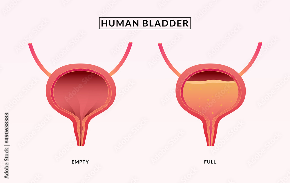Empty and Full Urinary bladder. medical illustration. Stock Vector