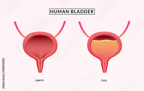 Empty and Full Urinary bladder. medical illustration.