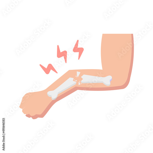 broken hand flat icon, medical icon