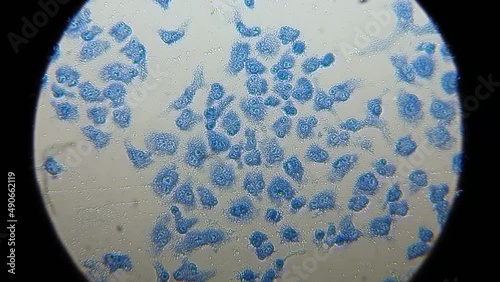 Antitumor activity experiment. Human cells under the microscope highlighted in blue color. Presence of binuclear cells photo