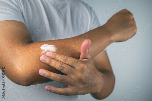 Foto Elbow injury from tennis and golf