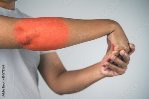 Elbow injury from tennis and golf. The man uses fingers to massage and stretch his arm. Pain symptom area is shown with red color. Healthcare knowledge. Medium close up shot.