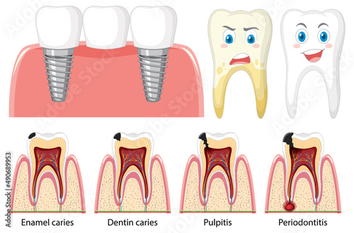 Set of all types of teeth on white background
