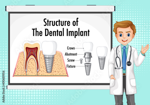 Infographic of human in structure of the dental implant