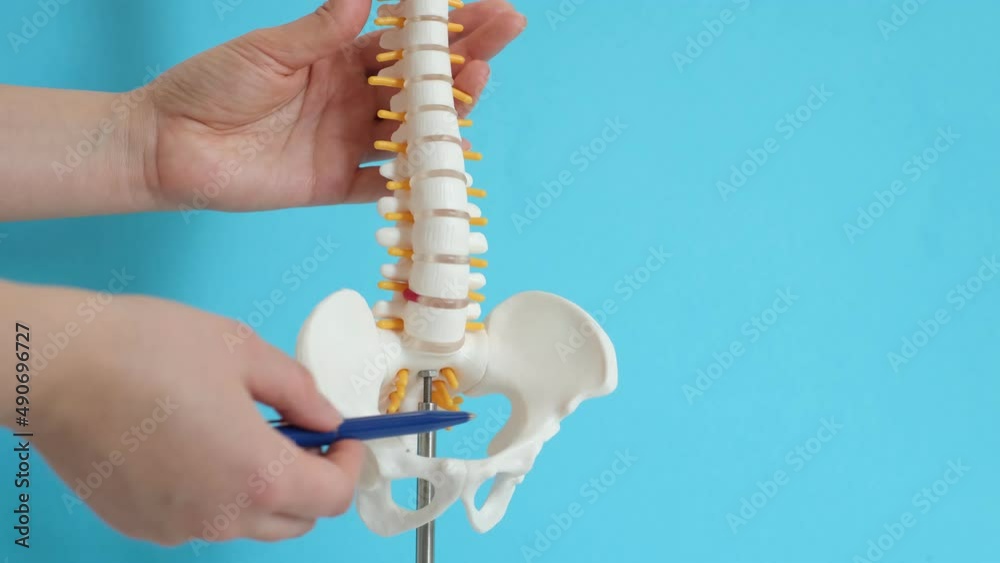 Intervertebral hernia of the cervical spine, rupture of the fibrous ...