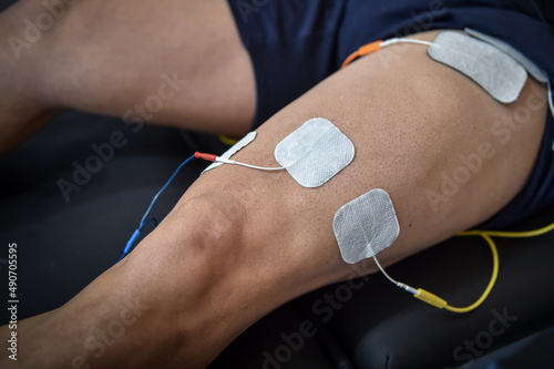Muscle stimulator device with electrodes applied to quadriceps by a professional physiotherapist