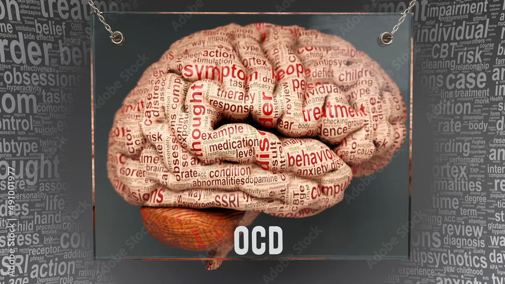 Ocd Visual Image Example Ocd anatomy - its causes and effects presented as an exhibit of a brain ...