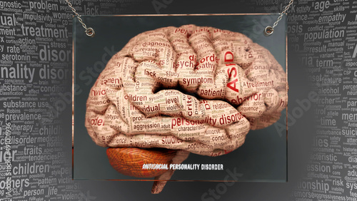 Bild auf Leinwand Antisocial personality disorder anatomy - its causes and effects projected on a human brain revealing its complexity and relation to human mind