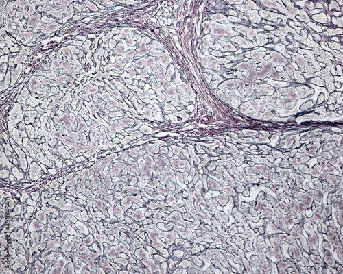 Human liver. Cirrhosis. Silver stain photo