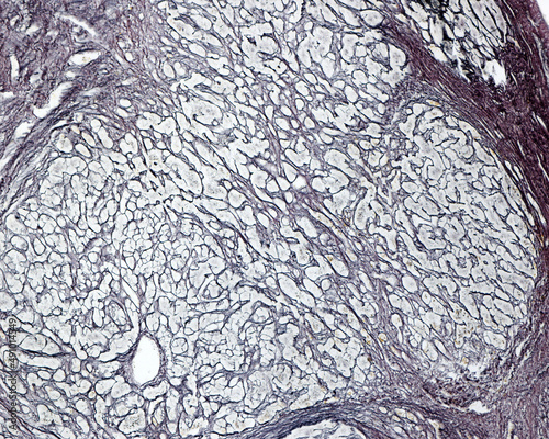 Human liver. Cirrhosis. Silver stain photo