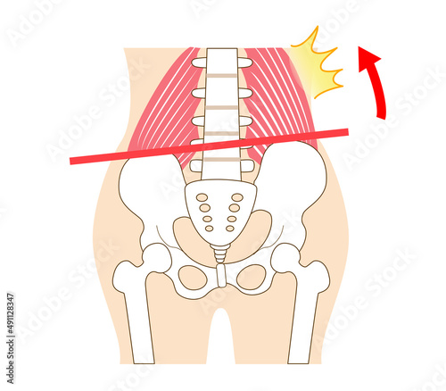 Left-right tilted pelvis and quadratus lumborum.