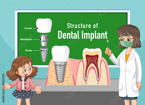 Infographic of human in structure of the dental implant