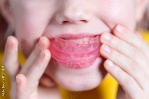 Six-year old caucasian girl shows myofunctional trainer in her mouth photo