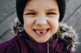 Close-up portrait of a small, blue-eyed, cheerful, smiling and toothless girl, a child of preschool age after an operation at the dentist in dentistry.