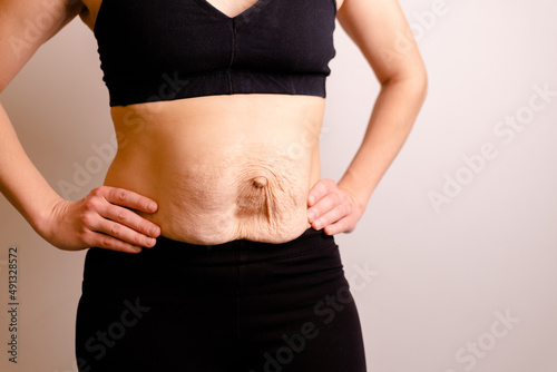 cropped woman dressed in black top and black leggings. Diastasis and umbilical hernia after pregnancy photo