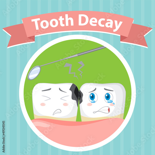 Dental healthy a big tooth decay poster