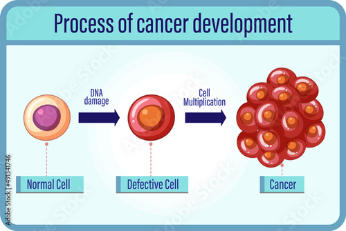 Process of cancer development