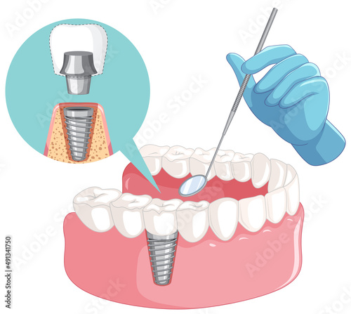 Dentist hand with human teeth model