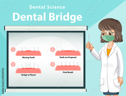 Infographic of human in dental bridge