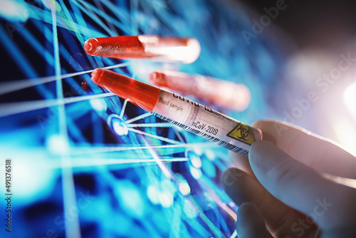 Test tube with patient blood for testing. Analysis for the virus. Coronavirus pandemic laboratory studies. Vaccine development.