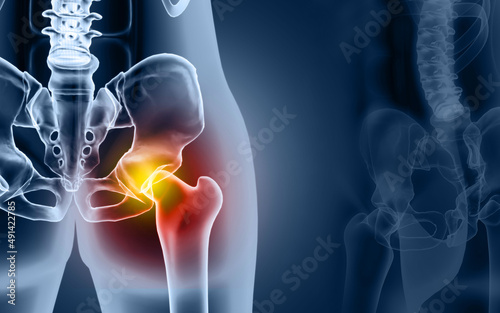Bones of the pelvis and hip, human anatomy, femur bone joint pain, X ray of the hip joint and femur. 3d illustration