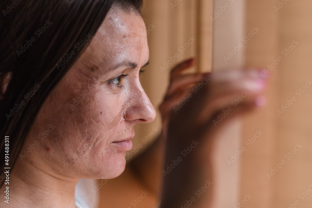 Obraz premium Close up photo of woman with dry skin looking in the window.