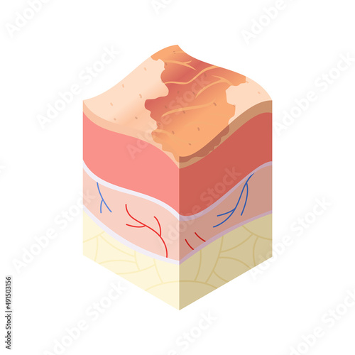 Skincare medical concept. Problems in cross-section of human skin horizontal layers structure. Anatomy illustrative model