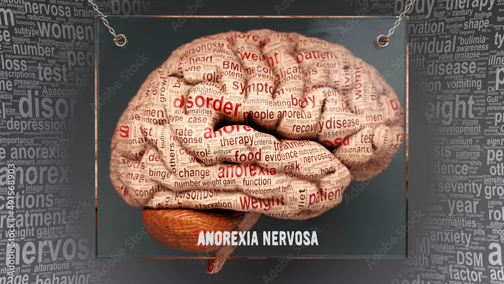 Anorexia nervosa anatomy - its causes and effects projected on a human brain  revealing Anorexia nervosa complexity and relation to human mind. Concept  art, 3d illustration Stock Illustration | Adobe Stock