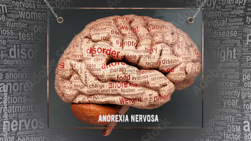 Anorexia nervosa anatomy - its causes and effects projected on a human brain revealing Anorexia nervosa complexity and relation to human mind. Concept art, 3d illustration photo