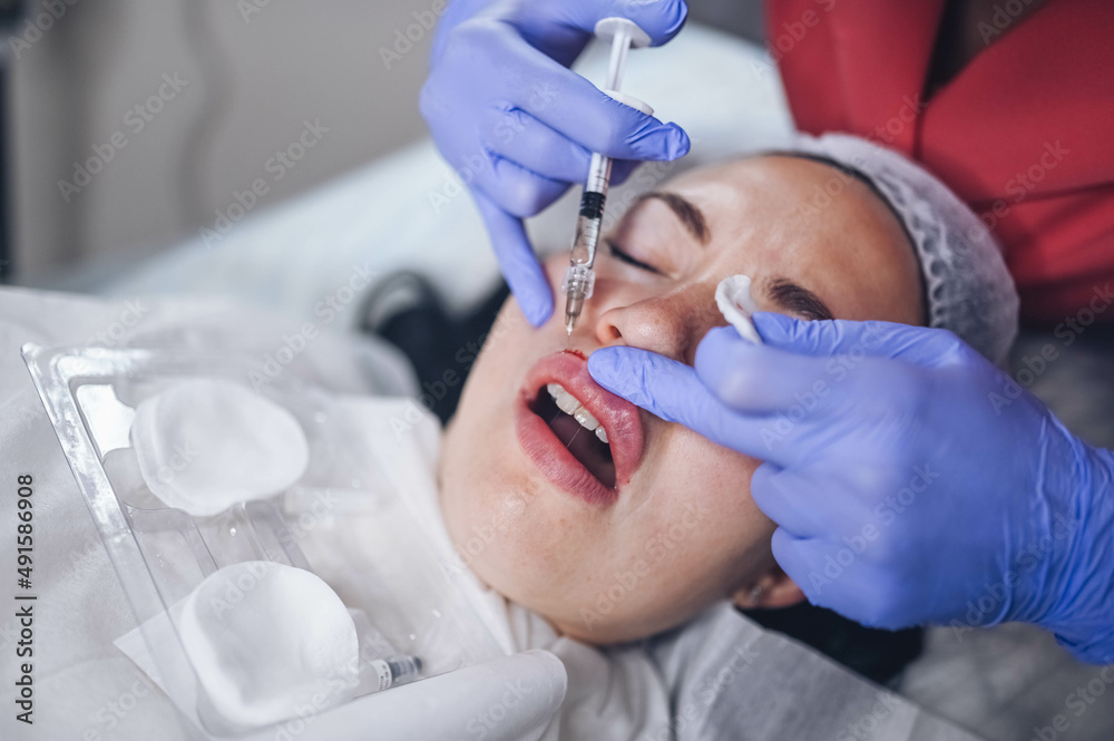 Cosmetologist doing painful lip augmentation procedure with hyaluronic acid. The beautician