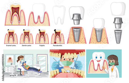 Set of all types of teeth on white background