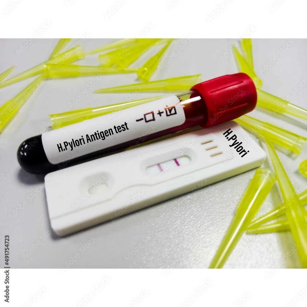 Blood sample with rapid test cassette for Helicobacter pylori(H. pylori