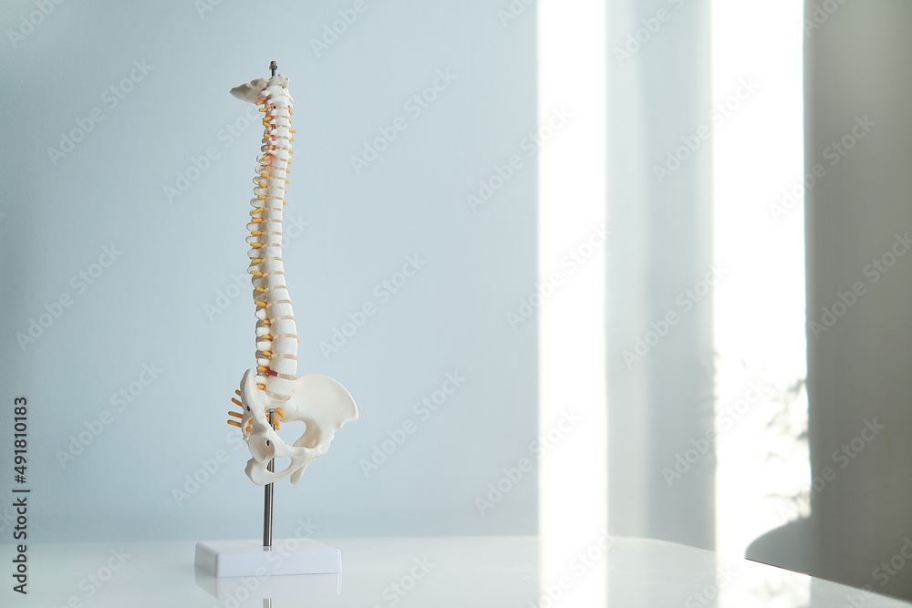 Intervertebral hernia of the cervical spine, rupture of the fibrous ring. Osteochondrosis, copy space. Human column plastic model complete pan at physiotherapy clinic - obrazy, fototapety, plakaty 
