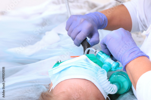 The child is under general anesthesia in the operating room. Treatment of caries of baby teeth.An unrecognizable face. Photo in a real operating room.
