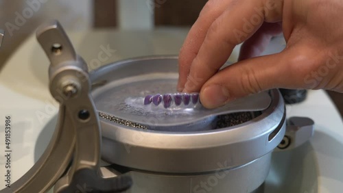 a dental technician takes out a model of the lower jaw after creating a dental cap