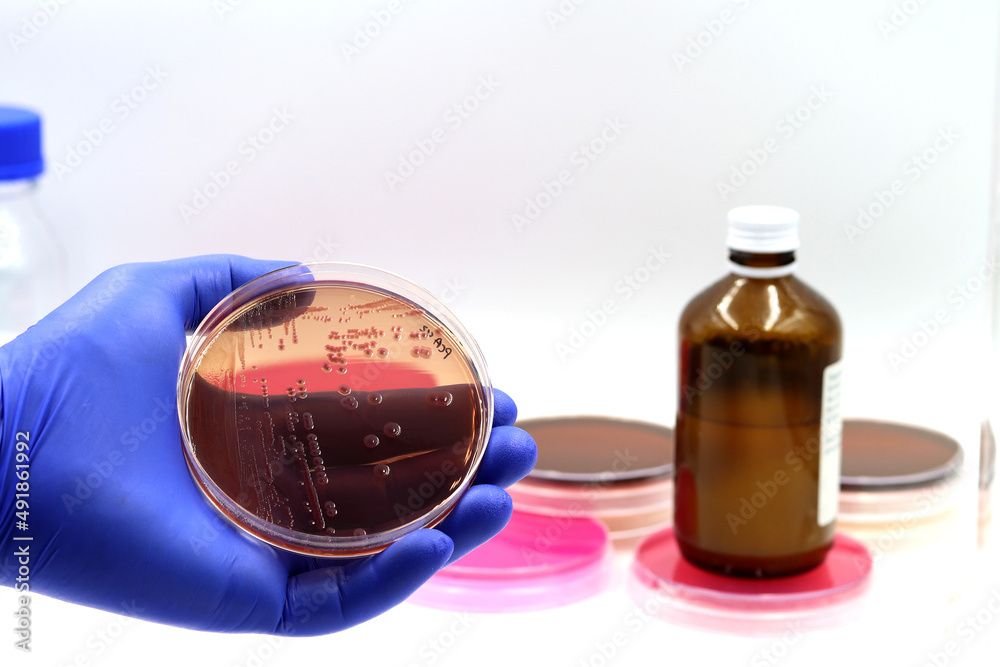 Microbiological culture of intestinal bacteria (enterobacteria, coliforms) in Violet Red Bile