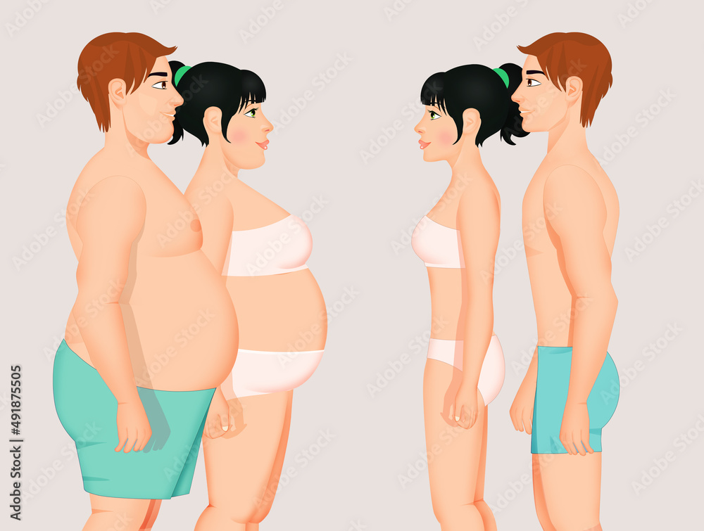 illustration of obese couple before and after diet illustration of obese couple before and after diet