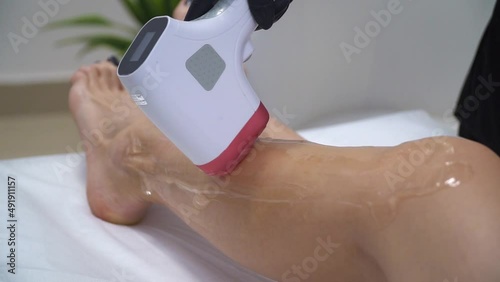 Laser epilation - hair removal procedure. Slider shooting