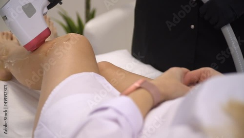 Laser epilation - hair removal procedure. Slider shooting