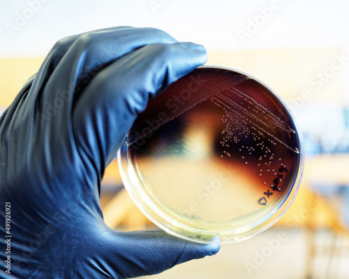Food safety pathogen Listeria monocytogenes isolated on Oxford agar from a food sample.