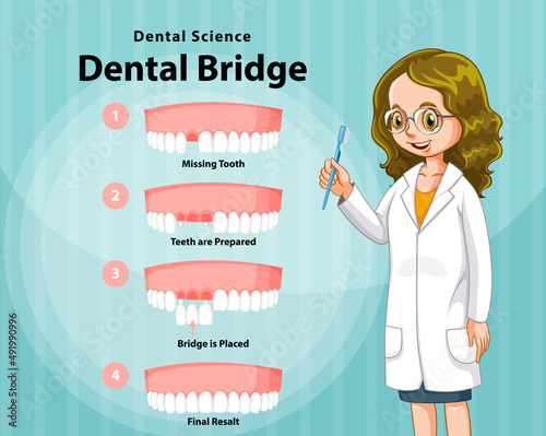 Infographic of human in dental bridge